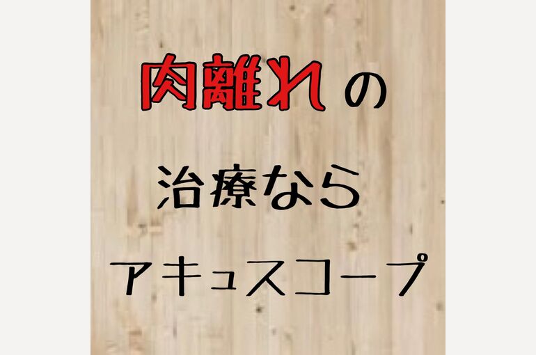 7217BAE5-1B14-4BE1-B566-6C34616661F6