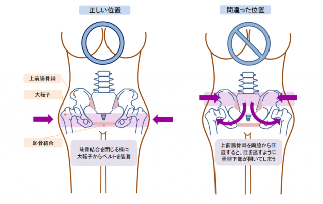 女性の正しい骨盤位置と間違った骨盤位置